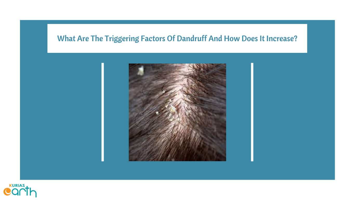 What are the Triggering Factors of Dandruff and How does it Increase?