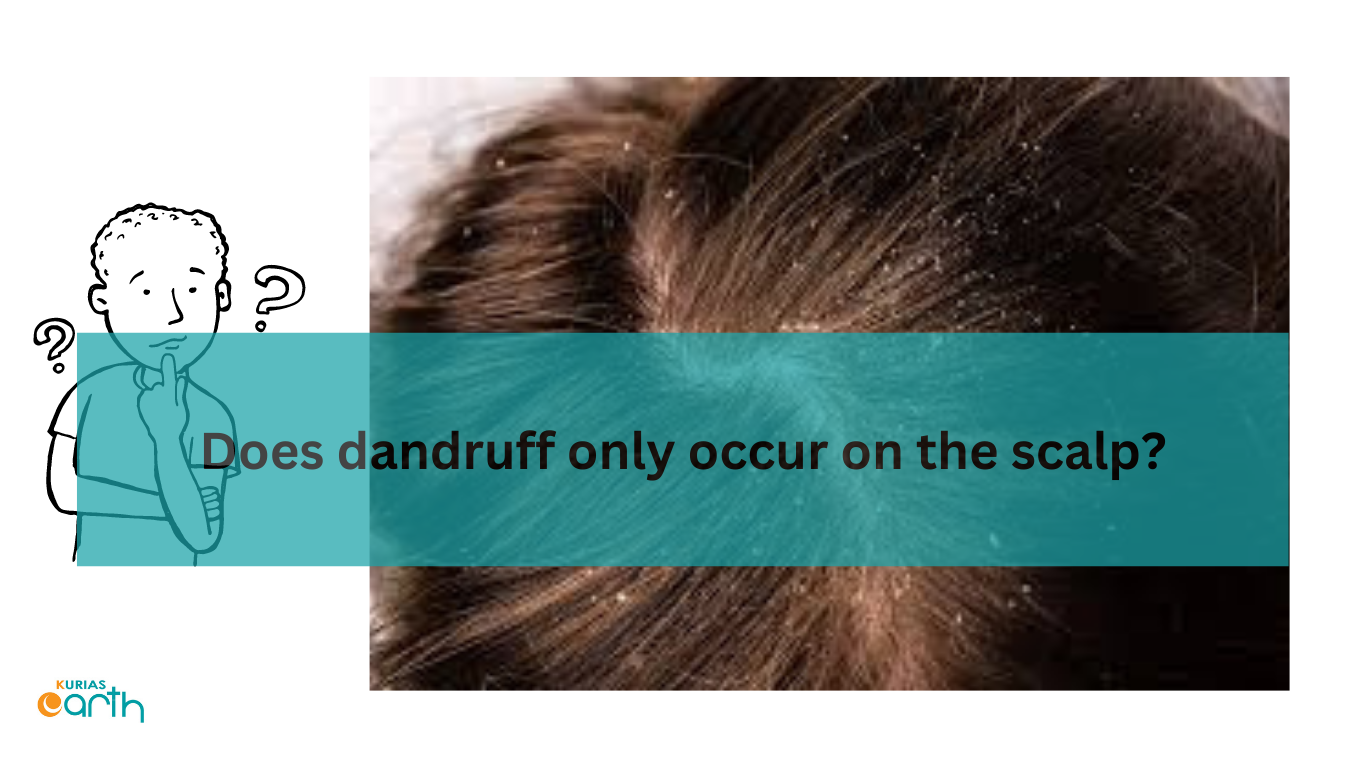 Does dandruff only occur on the scalp?