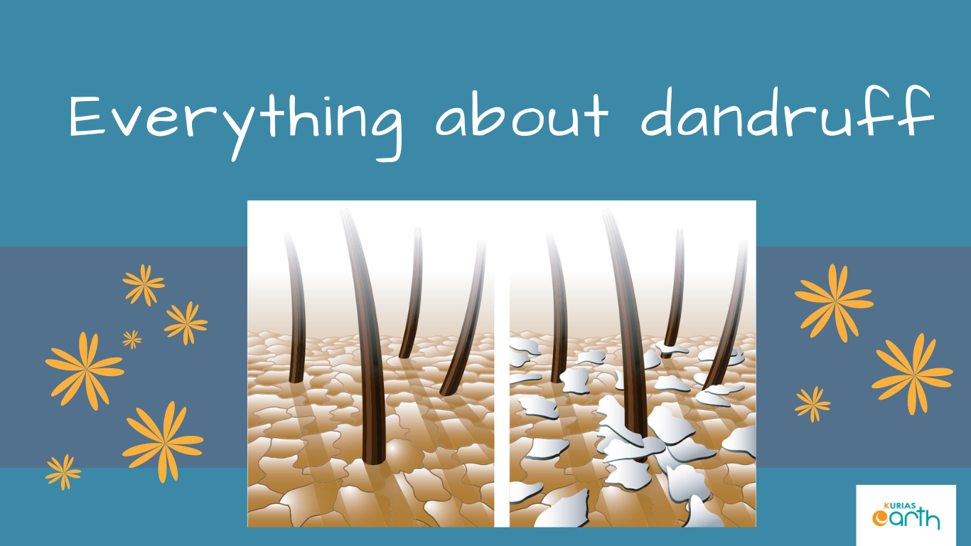 Everything About Dandruff