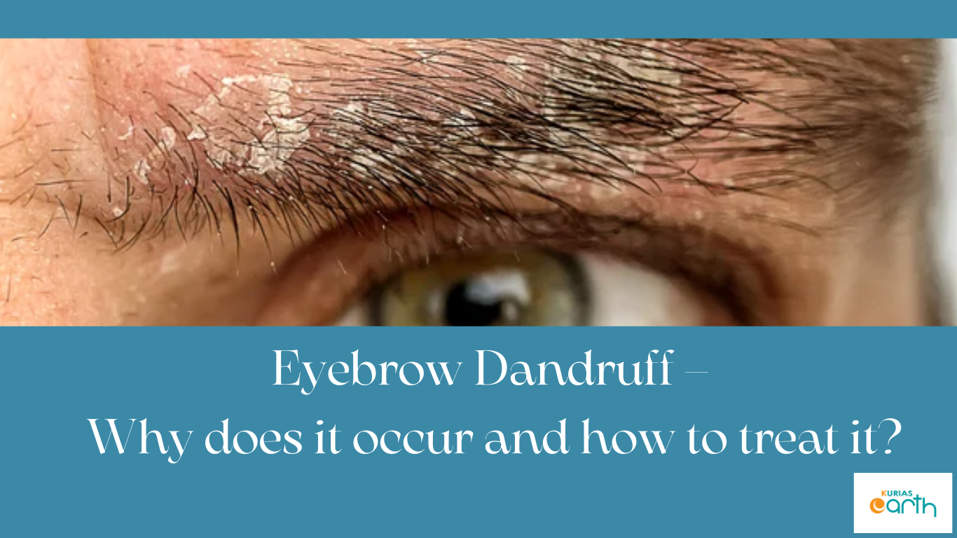 Eyebrow Dandruff – Why does it occur and how to treat it?