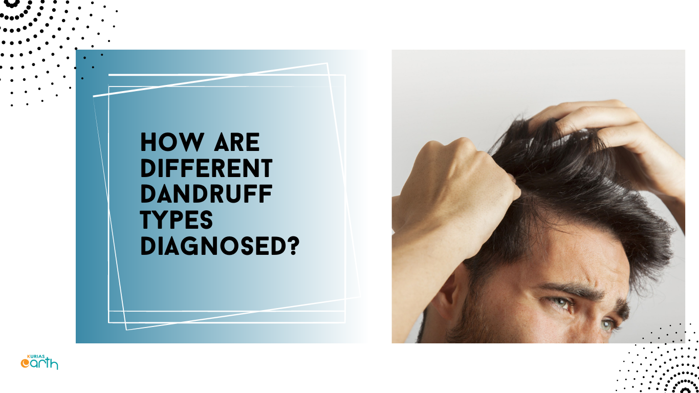How are Various Types of Dandruff Identified?