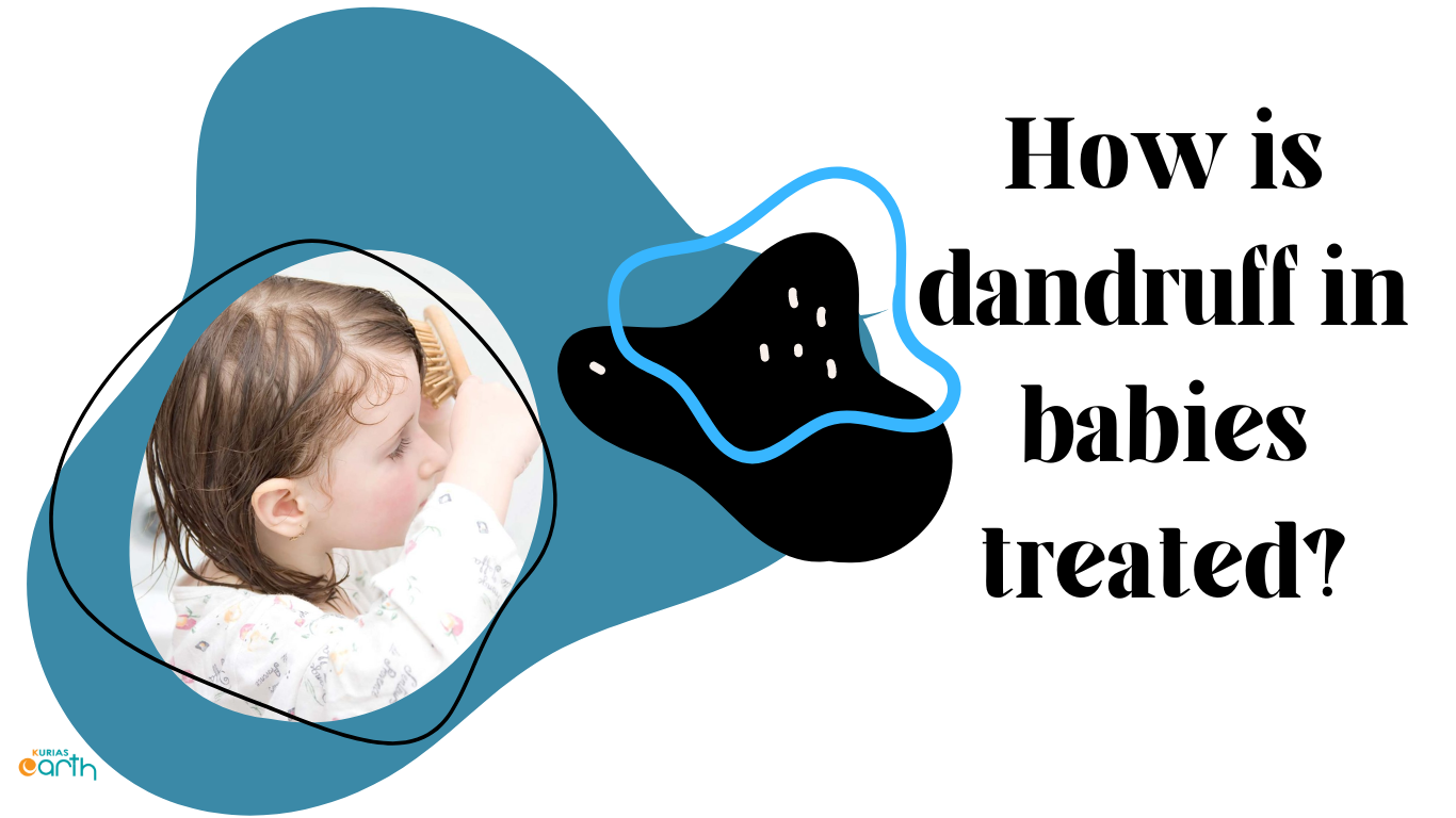 How is dandruff in Babies Treated?