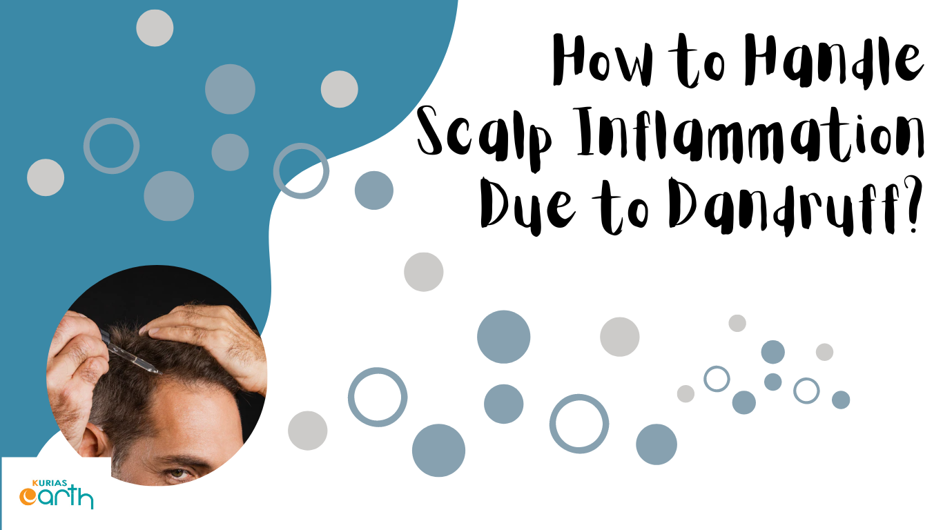 How to Handle Scalp Inflammation Due to Dandruff?