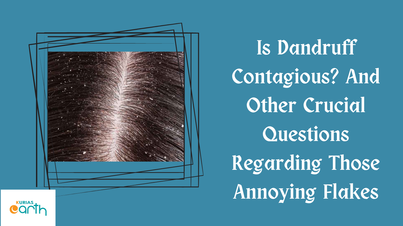 Is Dandruff Contagious? And Other Crucial Questions Regarding Those Annoying Flakes