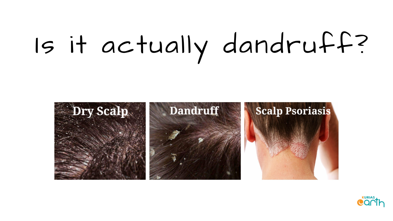 Is it actually dandruff? – How do I identify dandruff?