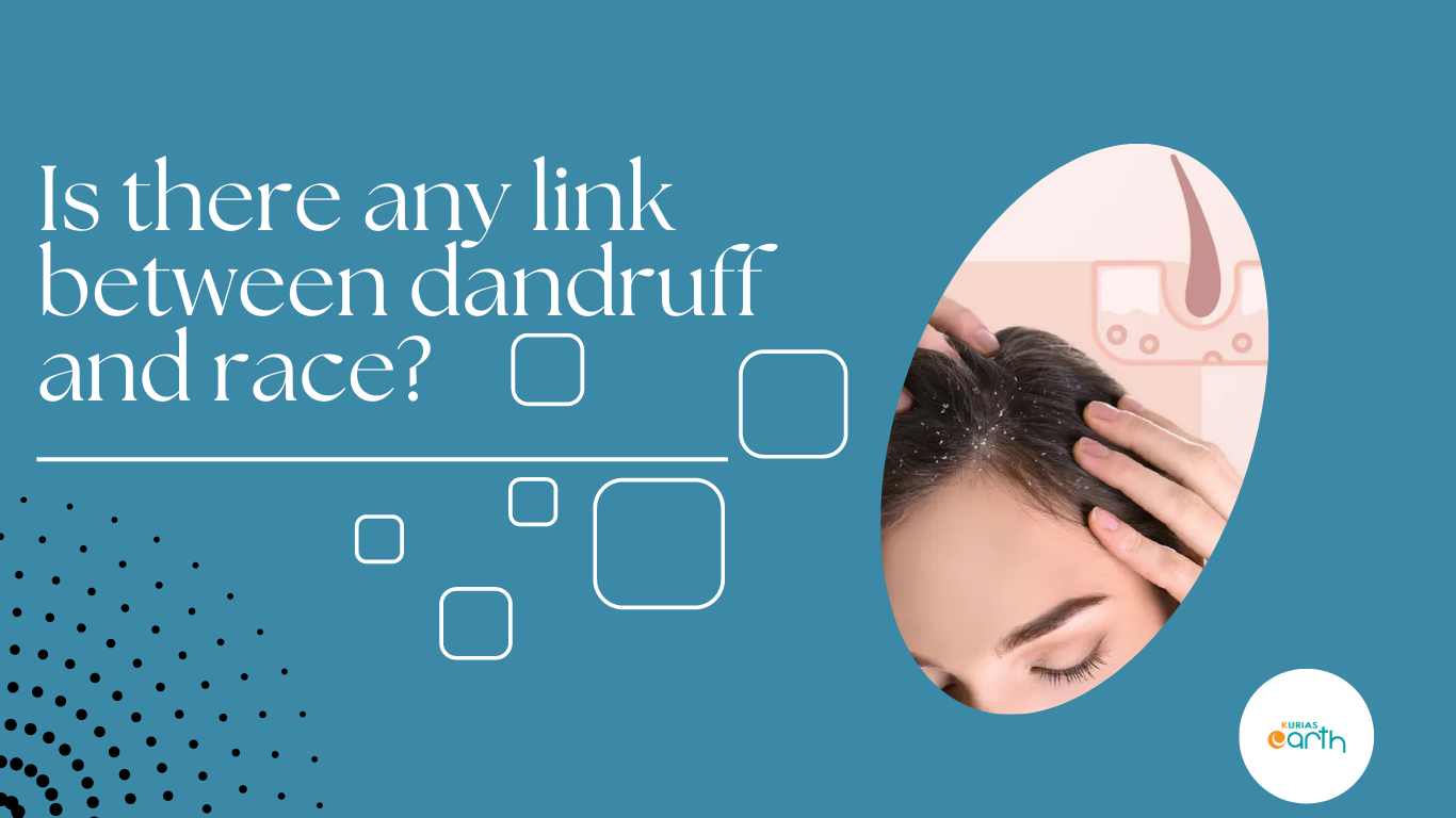 Is there any Link Between Dandruff and Race?