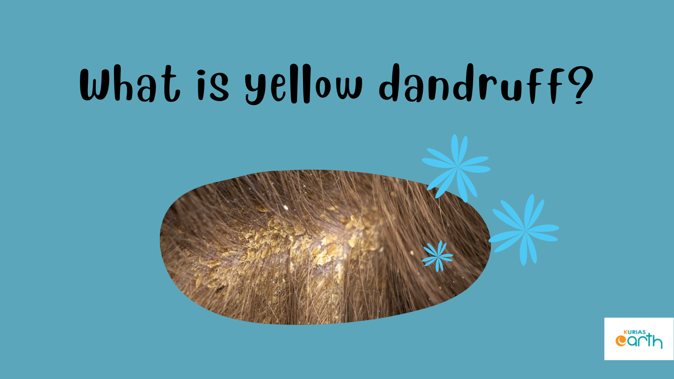 What Is Oily Yellow Dandruff? How To Treat It?