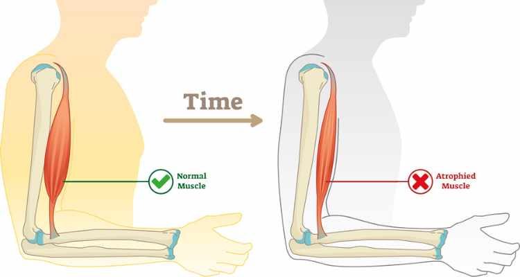 Ayurveda vs. Modern Medicine for Duchenne Muscular Dystrophy
